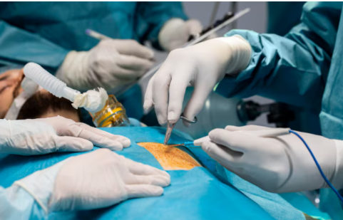 Choosing the Right Gallbladder Surgeon in Singapore: A Practical Guide to Safe and Effective Care Effective Care